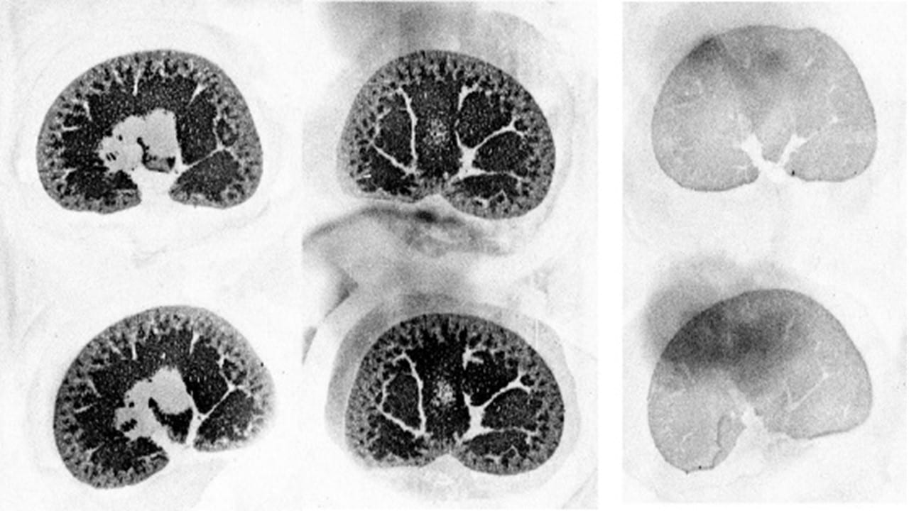 Autoradiography brain images Autoradiography brain images