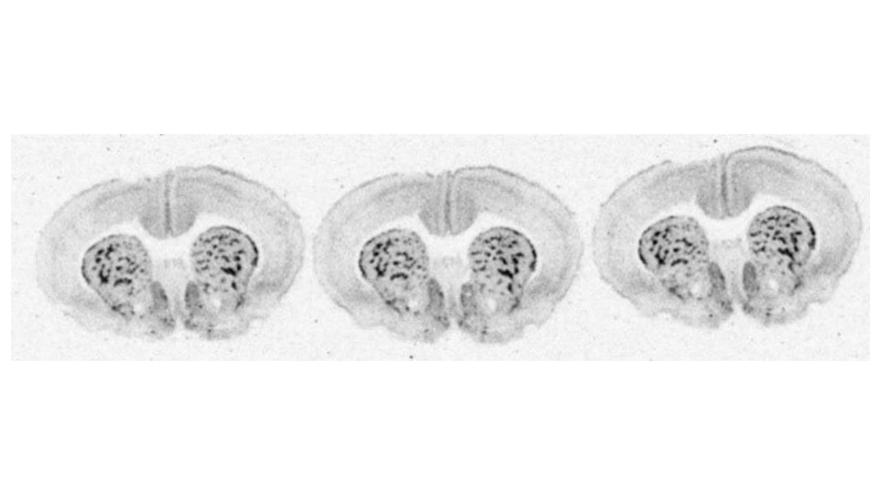 Autoradiography brain images Autoradiography brain images