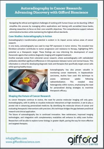 Autorad Cancer Picture 2