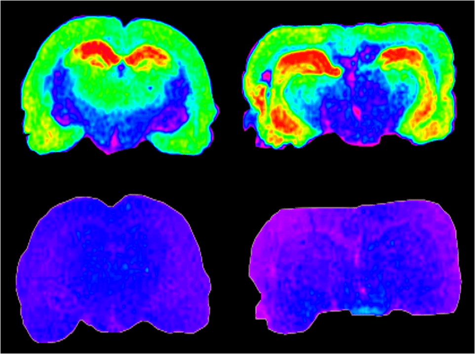 Neurology Scans Neurology Autoradiography Images